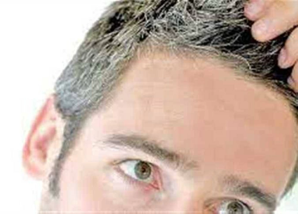 للحفاظ على لون شعرك الطبيعى.. 6 أطعمة تخفف من ظهور الشيب المبكر